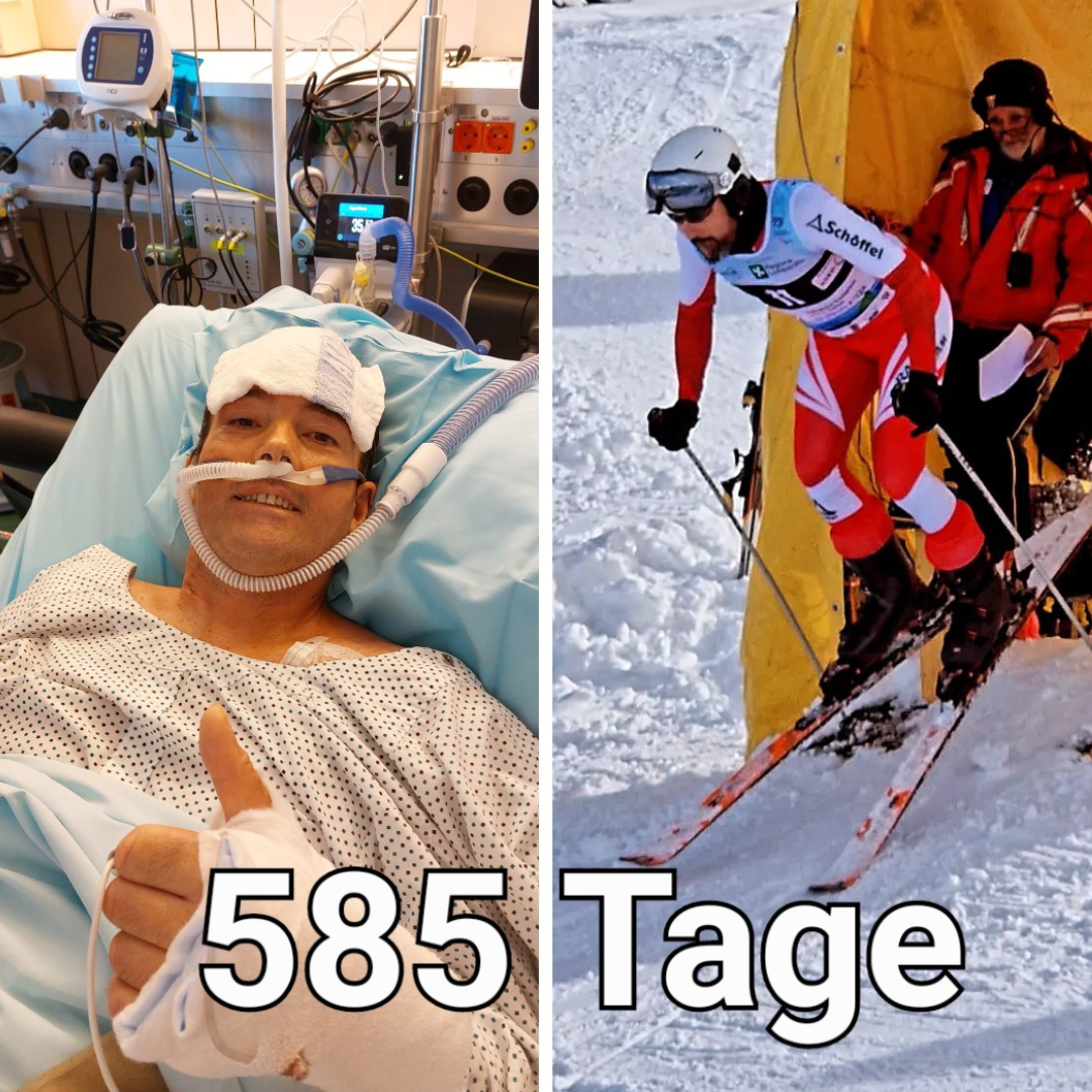 Zweigeteiltes Bild: Links ist Mann in Nahaufnahme auf der Intensivstation im Bett liegend zu sehen, rechts sieht man diesen Mann beim Ski Slalom starten, unten im Bild steht 585 Tage