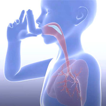 Mensch inhaliert Asthmaspray ohne Spacer, schematische Verteilung des Aerosols in den Atemwegen ist zu sehen