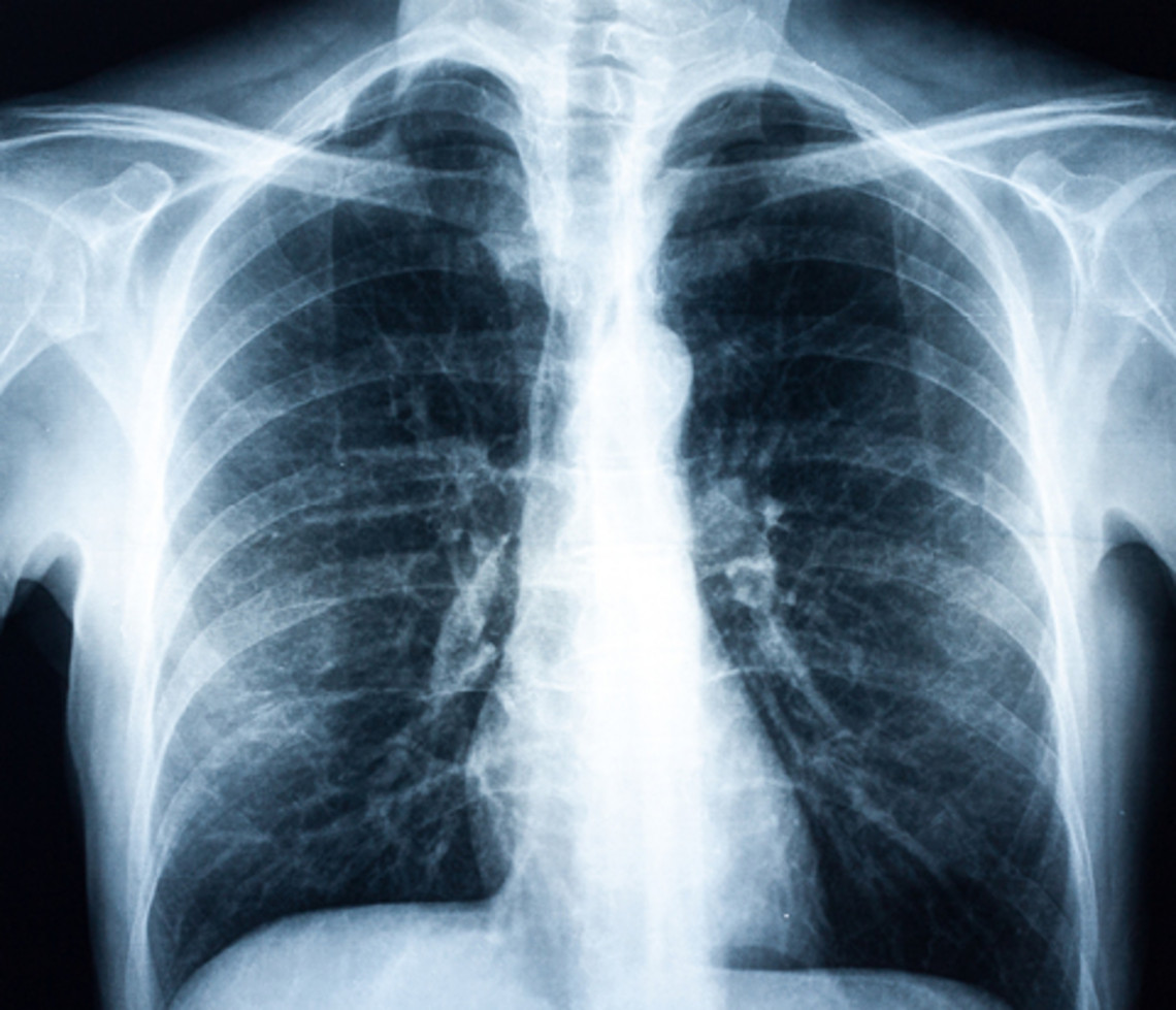 病情发展和可能出现的恶化