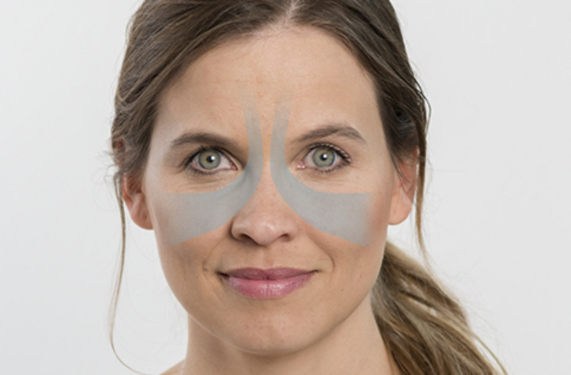 Sinusitis – when your nose keeps blocking up