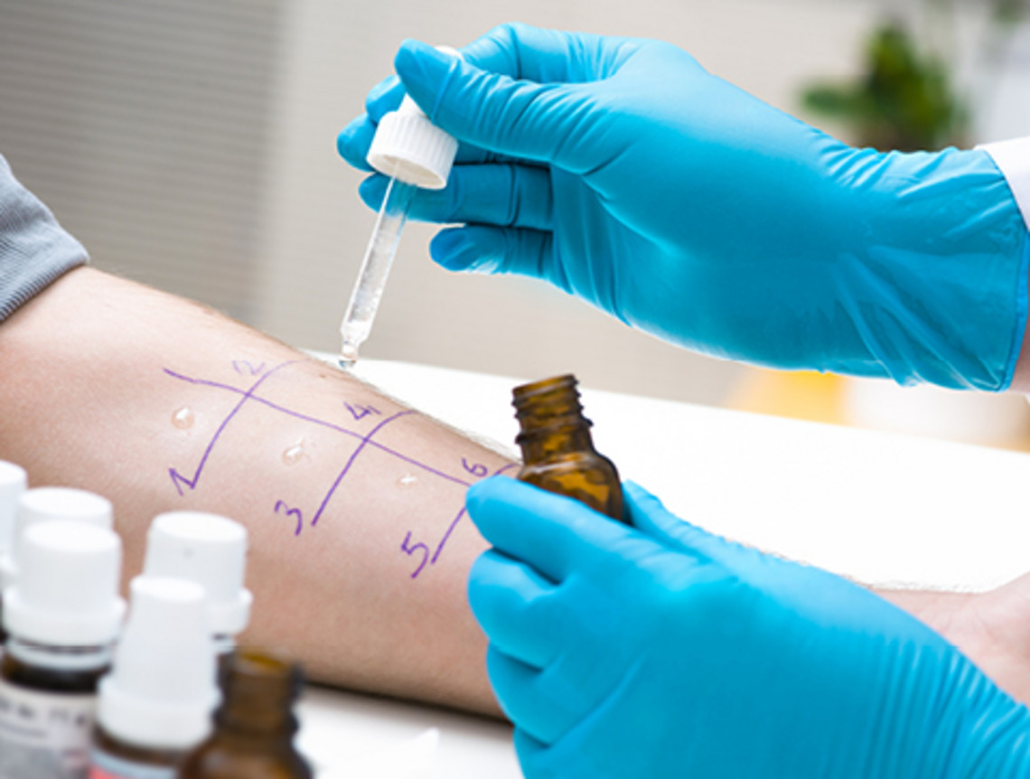 通过鼻镜检查和过敏试验明确