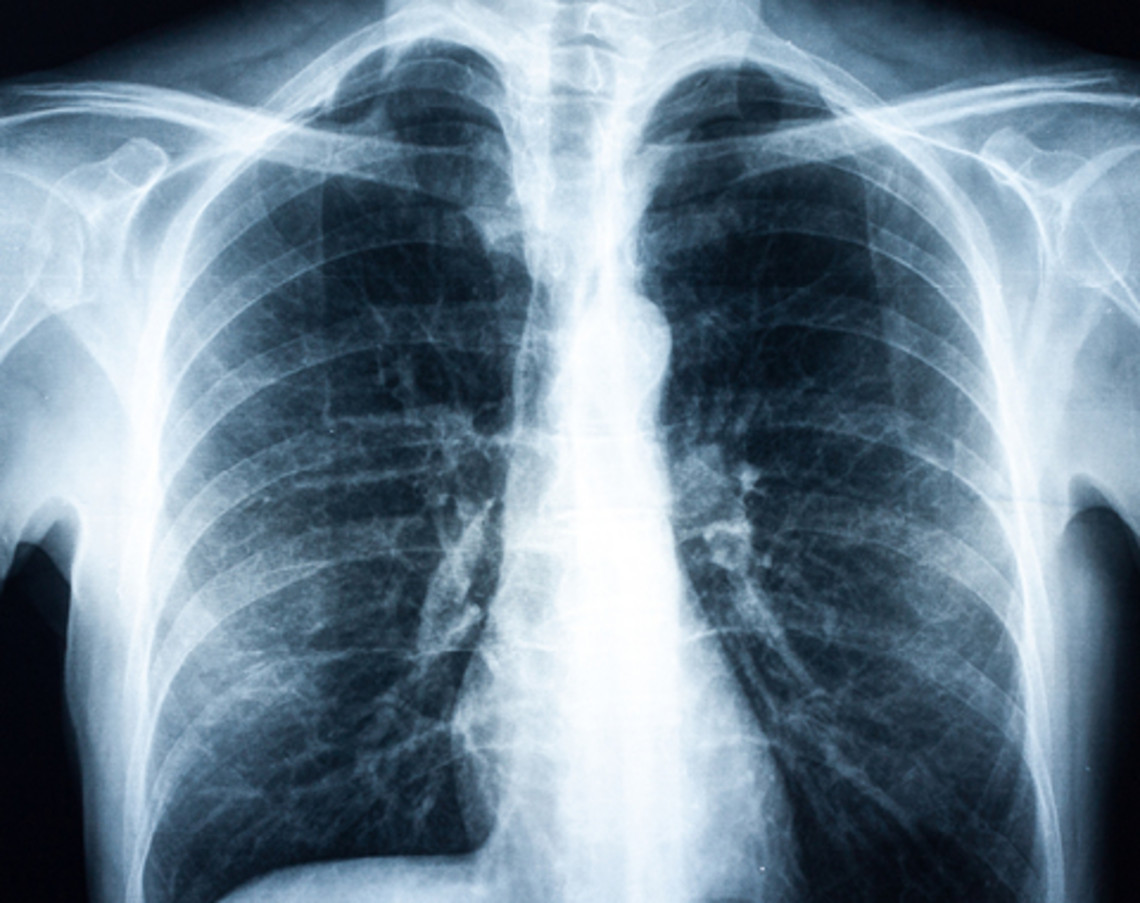 Development and possible progression