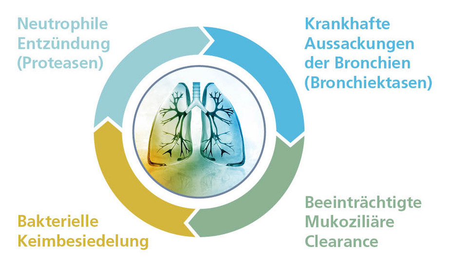Teufelskreis bei Bronchiektasie Teufelskreis bei Bronchiektasie