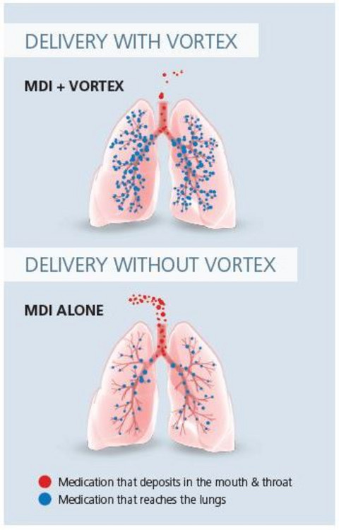 Delivery with and without VORTEX