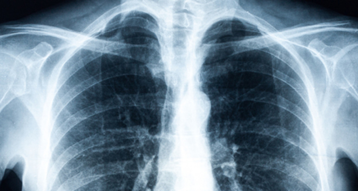 Développement et progression possible