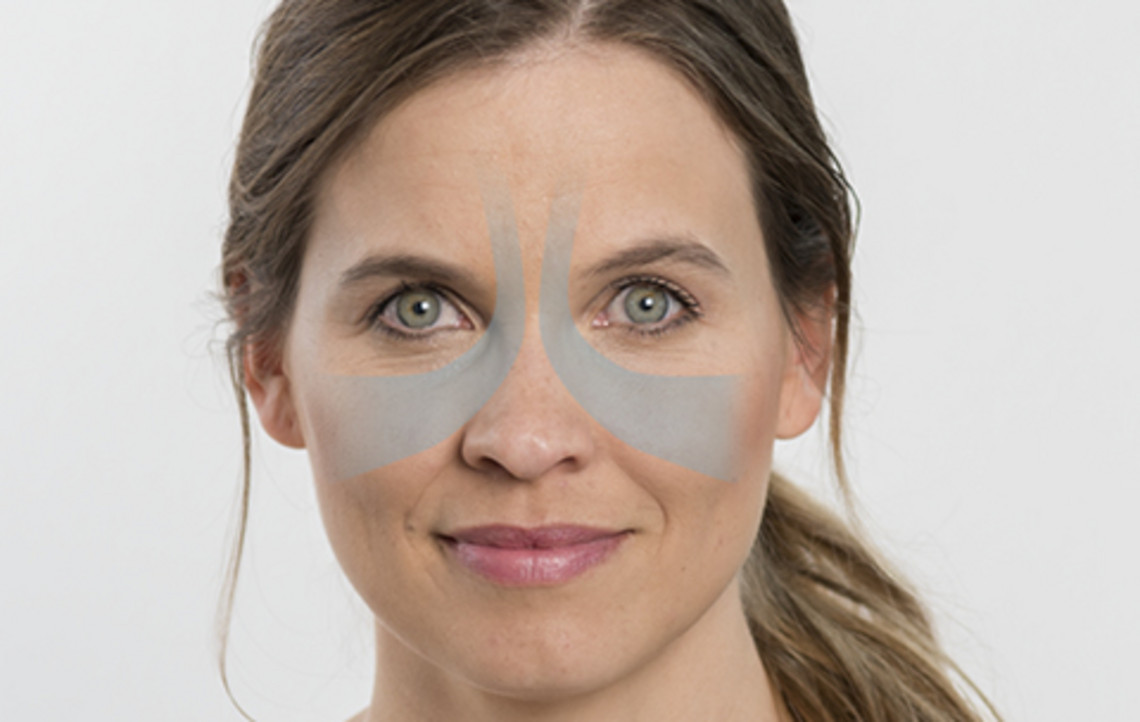 鼻窦炎——当一直鼻塞时