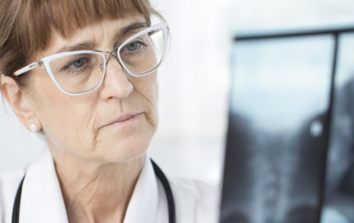 Bronchiectasis is a long-term condition affecting the airways