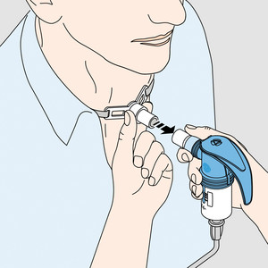 Schematische Darstellung eines Menschen mit Tracheostoma, der einen Vernebler zur Inhalation mit speziellem Adapter daran anschließt