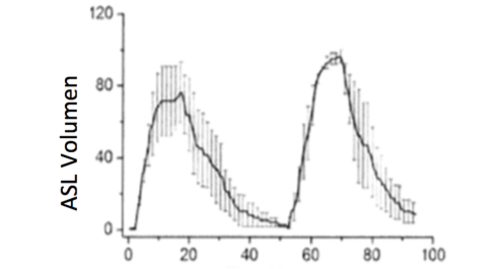 Neue Erkenntnisse zur Wirkung von hypertoner Salzlösung Neue Erkenntnisse zur Wirkung von hypertoner Salzlösung am Modell der menschlichen Lungenzellen (Human Bronchial Epithelium, HBE)