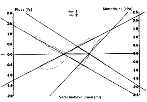Lungenfunktions-Befund bei Aufnahme und nach 10 Tagen