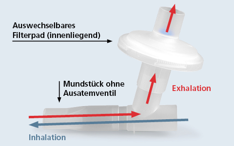 Funktionsprinzip des PARI Filter/Ventil Sets