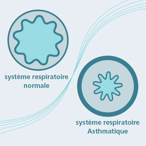 Systeme respiratoire Asthmatique