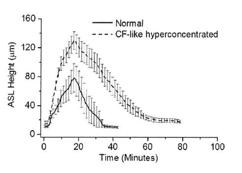 New findings on the effect of hypertonic saline solution on the model of human lung cells (Human Bronchial Epithelium, HBE)