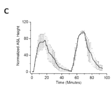 New findings on the effect of hypertonic saline solution on the model of human lung cells (Human Bronchial Epithelium, HBE)
