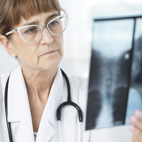 Bronchiectasis is a long-term condition affecting the airways