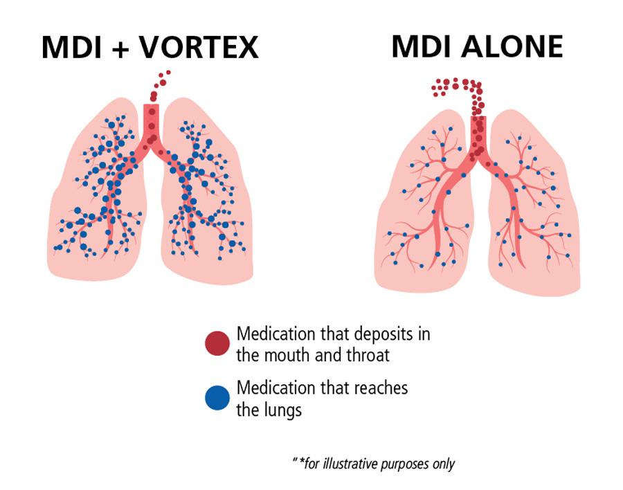VORTEX - Medication Diagram