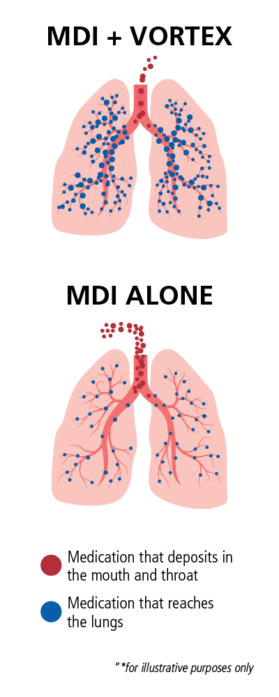 VORTEX Medication Diagram